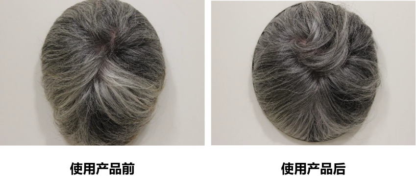 頭皮健康,紅斑,,丘疹,膿皰,評價方法