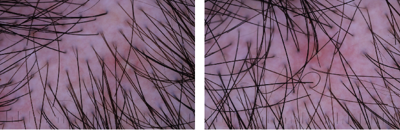 Scalp,health,Cosmetc,Efficacy,Evaluation