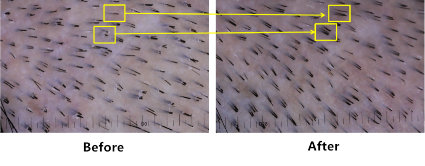 Scalp,health,Cosmetc,Efficacy,Evaluation